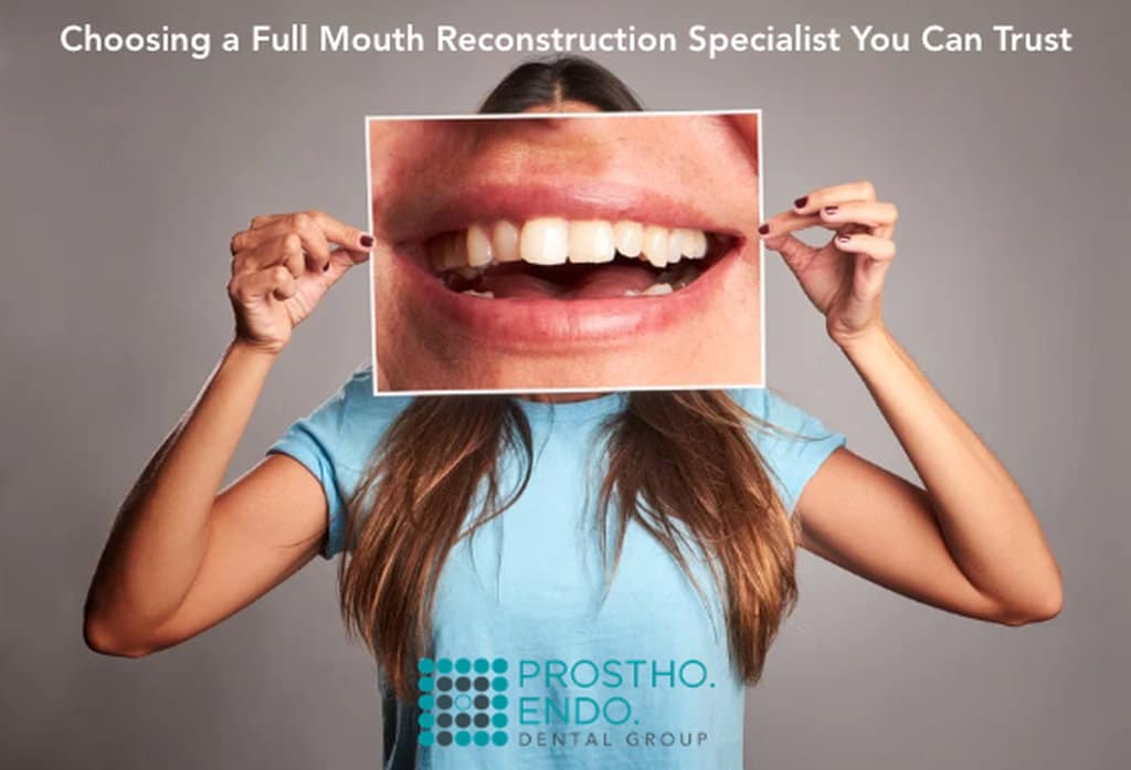 Full Mouth Reconstruction at Prostho Endo Dental Group