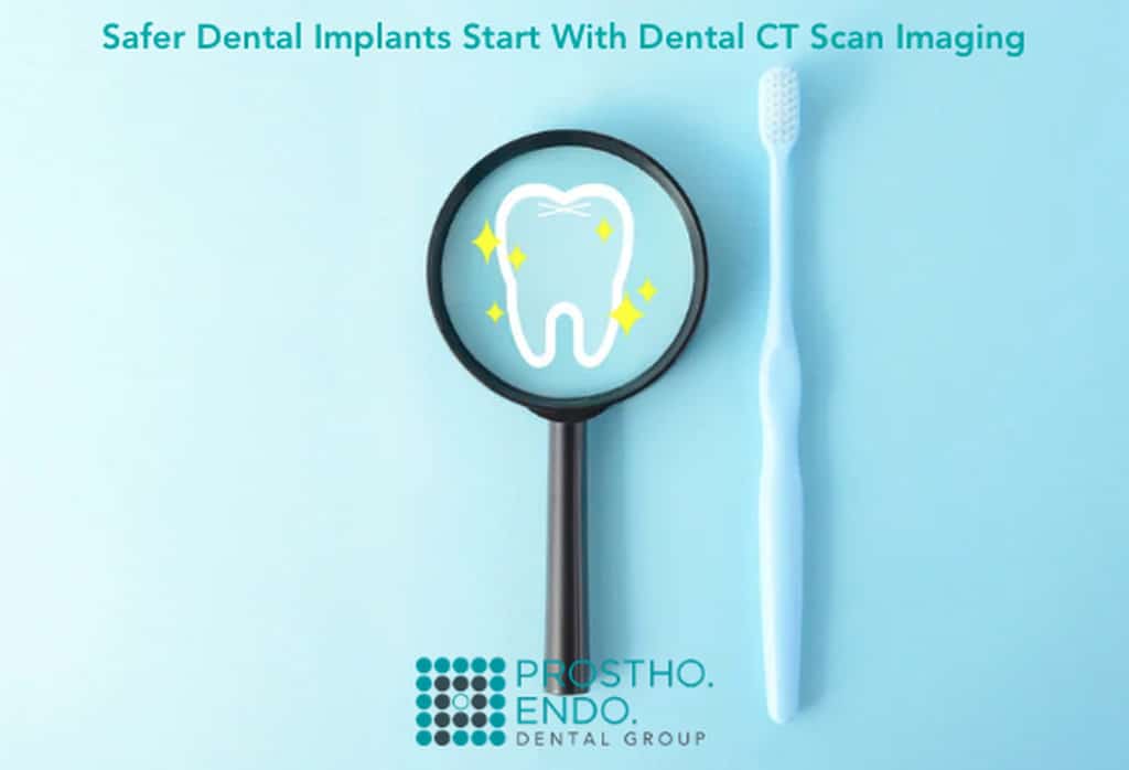 dental ct scan imaging at prostho endo dental group