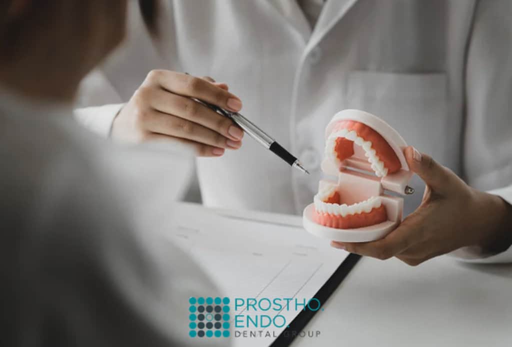 Custom Digital Smile Design
