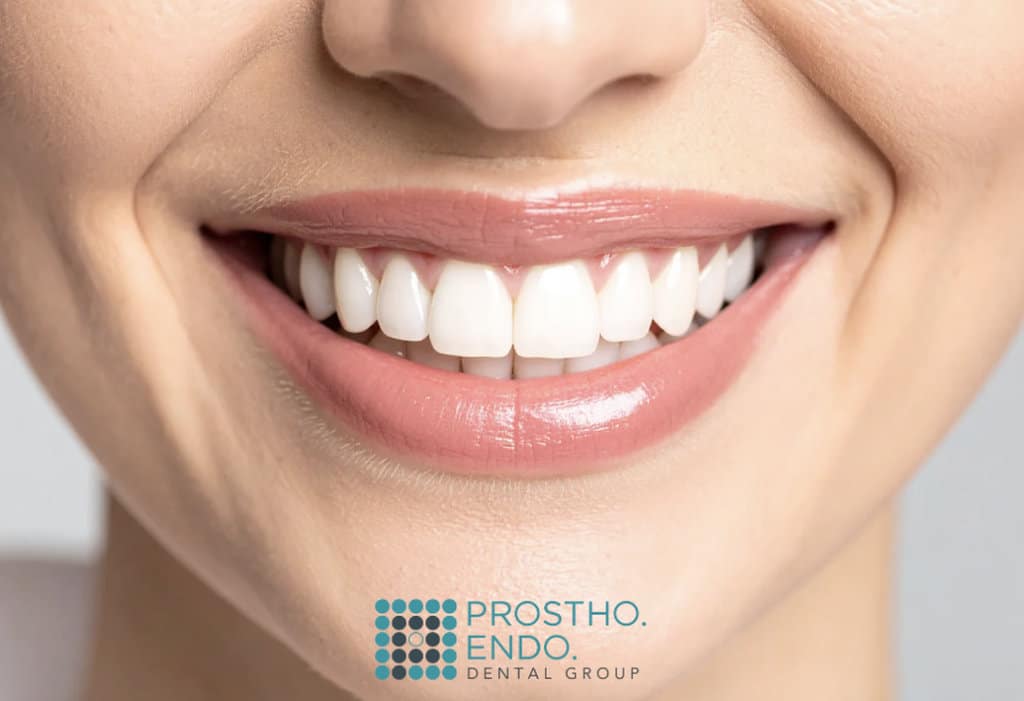 patient centered cosmetic dentistry prostho endo dental group