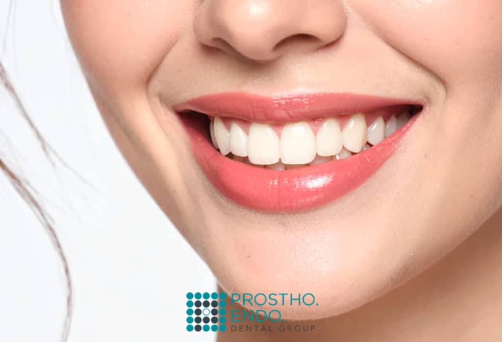Cosmetic Smile Prostho Endo Dental Group