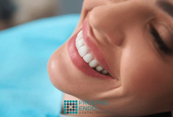 Smile Transformation results Prostho Endo Dental group 1